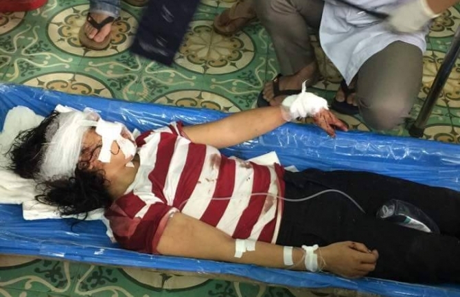 Chồng cầm dao cắt gân tay, gân chân vợ rồi bỏ trốn