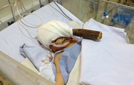 Lời kể của người mẹ bé 11 ngày tuổi bị chém vào đầu