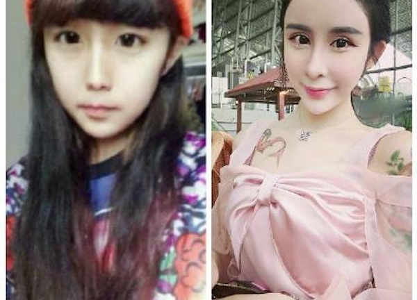 Cận cảnh gương mặt bị biến dạng của người mẫu 16 tuổi