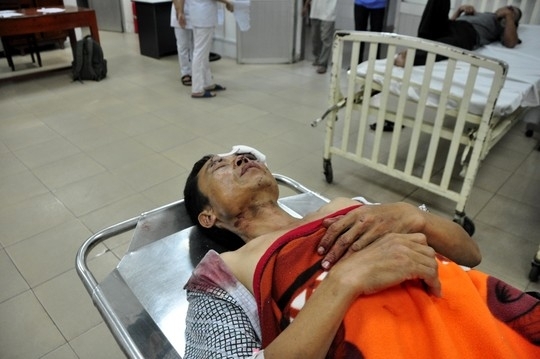 Quảng Ngãi: Xe khách tông xe tải, 10 người cấp cứu