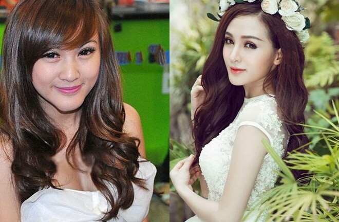 Hot girl Kelly trải lòng về 5 lần phẫu thuật thẩm mỹ và chuyện suýt hoại tử cằm