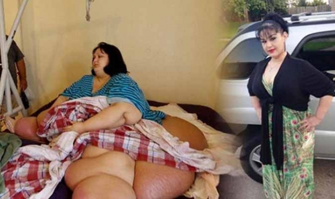 Hành trình giảm 370 kg của cô nàng từng nặng “nửa tấn”