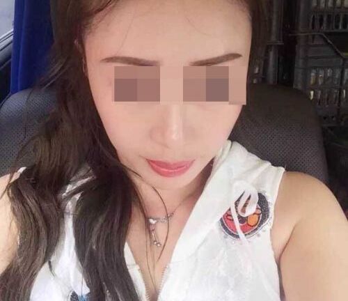 Mỹ nữ chết oan vì phẫu thuật ... “nơi thầm kín”