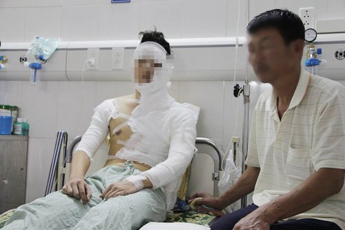 Nam sinh trường Điện ảnh bị tạt axit trên đường đi nhận quà