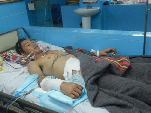 Kỳ 11: Ca phẫu thuật cứu mạng nạn nhân đang “chờ chết”