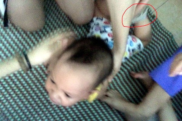 Vụ trẻ 14 tháng tuổi bị trói chân tay: