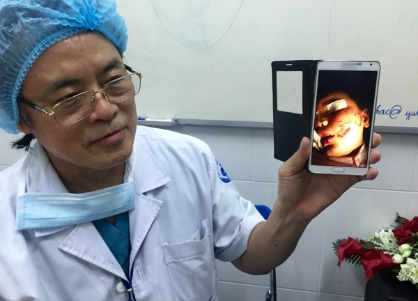 Thương tâm bé trai 3 tuổi bị chó cắn khâu 200 mũi