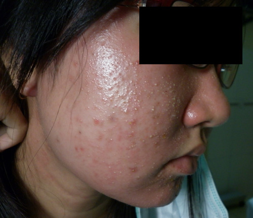 Hiểm hoạ từ chất bảo quản trong sản phẩm làm đẹp đến sức khỏe người tiêu dùng