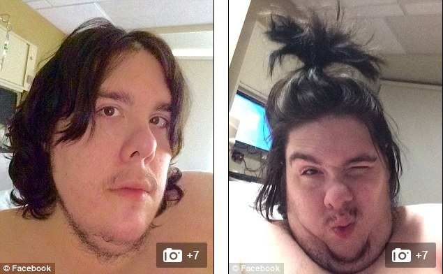 Người đàn ông nặng 360 kg bị đuổi khỏi bệnh viện vì tự ý gọi... pizza