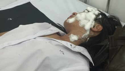  Vụ 2 nữ sinh bị tạt axít ở Sài Gòn: Tạm giữ người yêu cũ của nạn nhân