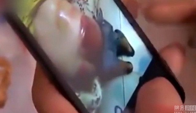 Không làm bài tập về nhà, bé lớp 4 bị giáo viên đánh dã man