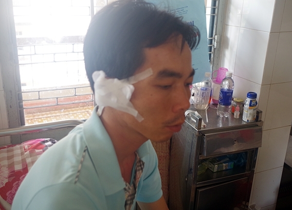 Đang làm nhiệm vụ, Phó Công an xã bị côn đồ chém lìa tai