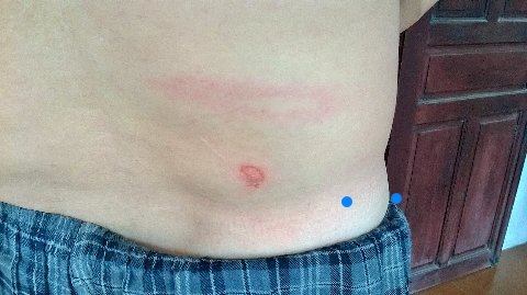 Nhóm côn đồ xông vào nhà tấn công Phó chủ tịch HĐND xã