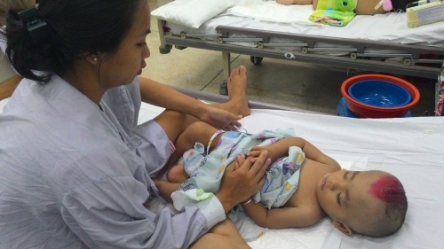 Bé trai bị ngã chấn thương sọ não tại nhà giữ trẻ đang dần bình phục