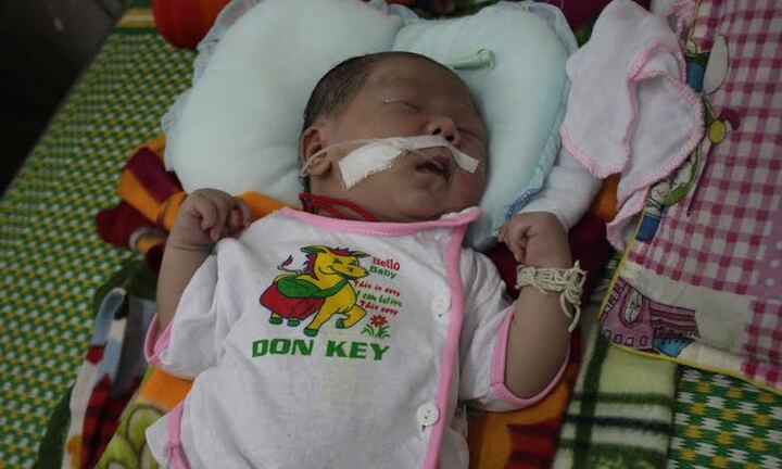 Cứu sống bệnh nhi nhiễm trùng uốn ván cuống rốn sơ sinh nguy kịch