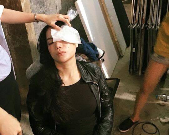 Trương Ngọc Ánh tai nạn trên trường quay đúng ngày sinh nhật