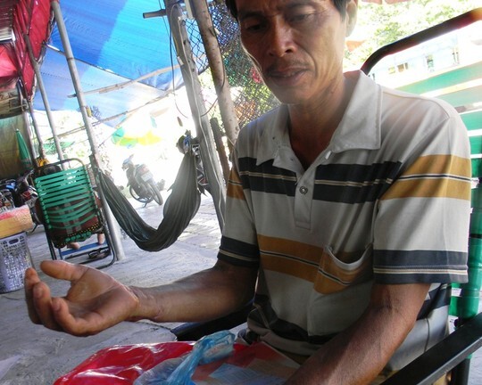 Bắt khẩn cấp kẻ chém 2 người rồi vào viện tâm thần điều trị