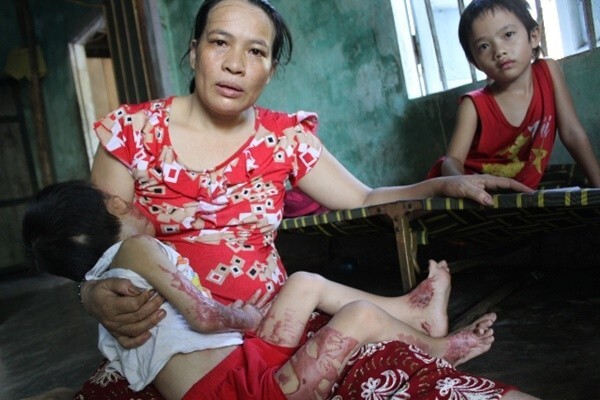 Em bé ở Quảng Nam: Mẹ ơi! Khi mô lột mặt nạ ra để con được đến trường