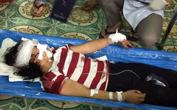 Hôm nay (1/4), xử vụ chồng cắt gân tay, chân vợ