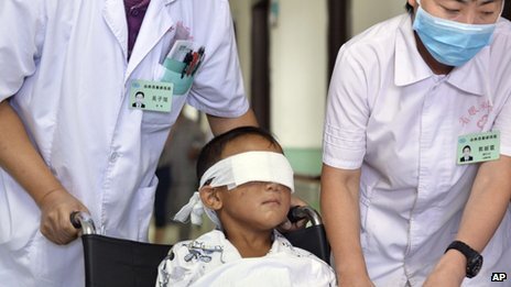 Nghi phạm móc mắt bé trai Trung Quốc có thể là bác dâu