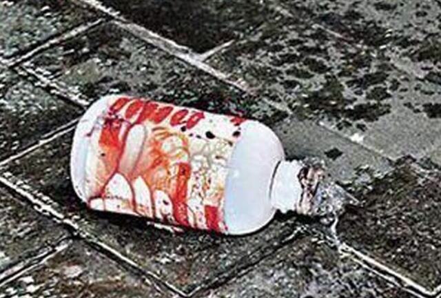 Gây sự với công nhân, tạt a-xít cháy mặt ông chủ