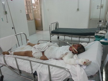 Giận chồng không tắm, thai phụ tưới dầu hoả tự thiêu