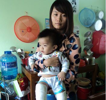 Phụ huynh hoảng hốt khi con bị gãy 2 chân từ nhà trẻ về