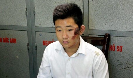 Nỗi ám ảnh sau đêm phi tang của bảo vệ thẩm mỹ viện Cát Tường