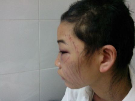 Ghen tuông điên loạn, chồng bắt vợ tự cắt tóc, rạch mặt