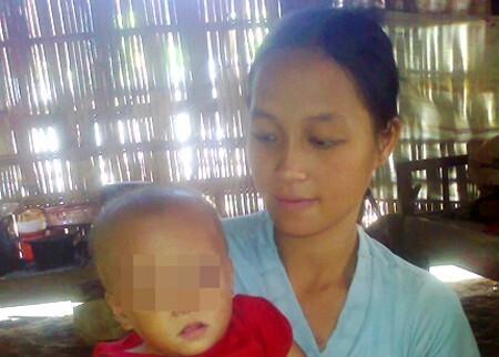 Tin tức 24h: Hi hữu bé gái có 2 