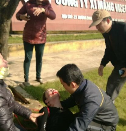 Tin tức 24h: Bị sếp lừa tình, bồ nhí treo cổ trước cổng công ty?