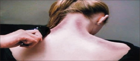 Tử vong sau khi được 