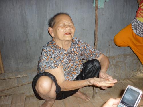 Cụ bà mù lòa kể lại phút bị cướp 18 chỉ vàng