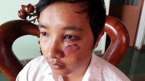 Côn đồ “xử” thầy giáo nhờ...học sinh cung cấp thông tin