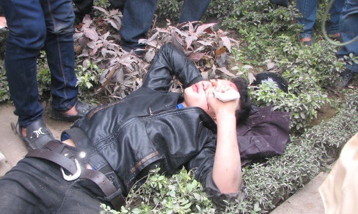 Công an Thanh Hóa đuổi người tham gia giao thông ngã gãy răng?