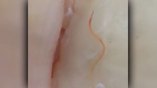 Phát hoảng giun còn sống trong cá tươi tại siêu thị