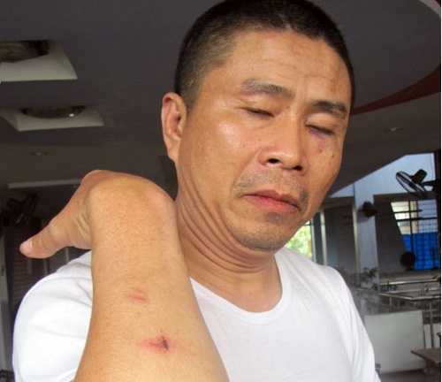 Truy bắt nhóm côn đồ đánh dằn mặt một tài xế xe khách