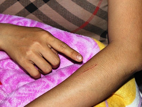 Hoang mang với  tin đồn rùng rợn về nạn rạch mông