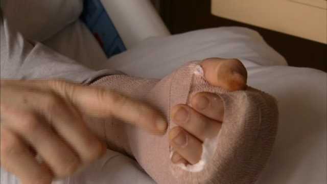 Nhập viện vì sạc iPhone phát nổ