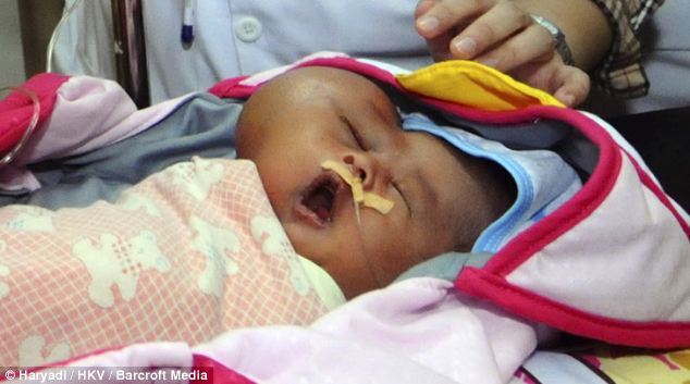 Kỳ lạ bé sơ sinh mang khuôn mặt hình trái tim