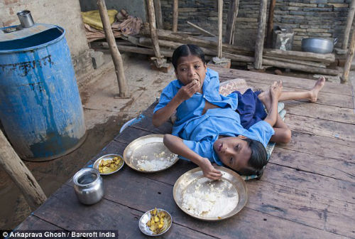 Cuộc sống của hai bé trai song sinh dính liền