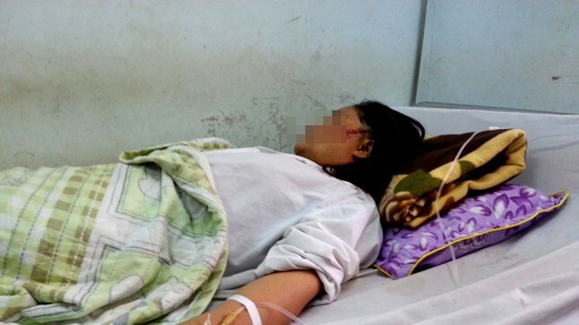 Bố chồng bị tố sàm sỡ, cầm dao chém rách mặt con dâu