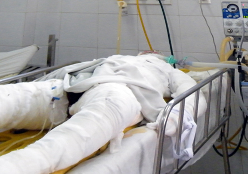 Dùng xăng đốt em gái của 