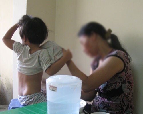 Cả mẹ lẫn con lây viêm gan A từ người giúp việc