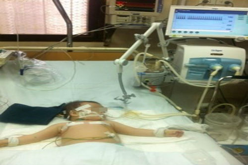 Trẻ 13 tháng tuổi nguy kịch vì uống phải luyn