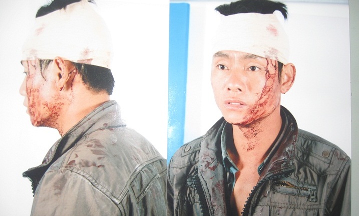 Dân tố bị công an xã hành hung, chính quyền làm ngơ