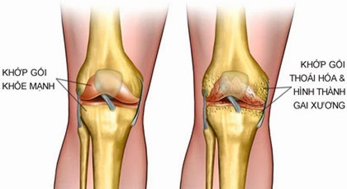 Bảo Thanh Đường  Nơi Chữa Trị Các Bệnh Khớp Uy Tín