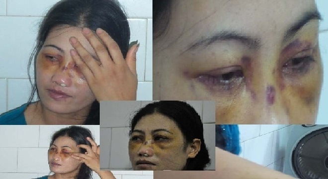 Sự thực đau xót vợ bị chồng bạo hành, bắt ăn phân lợn
