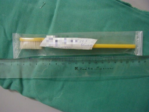 Giảm cân, thiếu nữ nuốt chửng cả bàn chải đánh răng