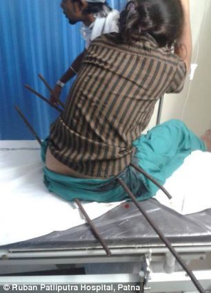 Thiếu nữ bị xuyên ba thanh sắt qua người thoát chết kỳ diệu